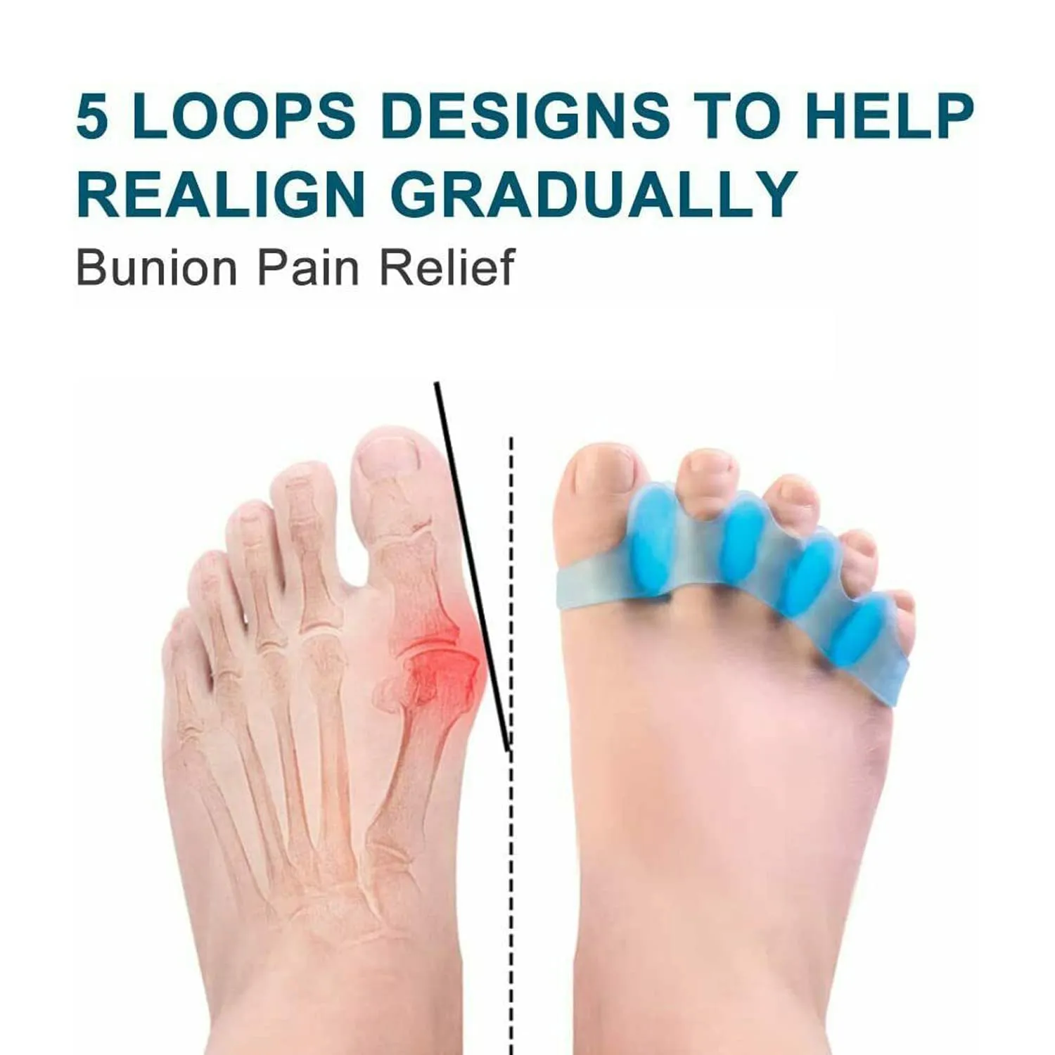 6 Pcs Gel Toe Separators Toe Spacers for Feet, Bunion Corrector for Women & Men, Hammer Toe Straightener, for Overlapping Toes, Claw Toes